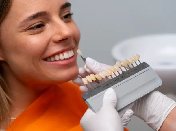 Dental Veneers